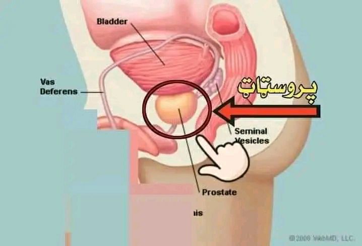 دوا پروستات