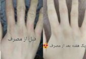 کرم گیاهی نرم کننده دست و صورت