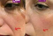 ماسک گیاهی شاداب کننده و ضد چین و چروک