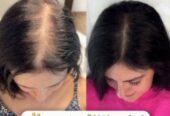 شامپو های ضد ریزش مو برای انواع کف سر