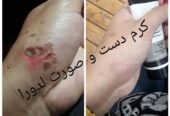 کرم دست و صورت لادرا