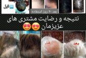 شامپو های ضد ریزش مو برای انواع کف سر