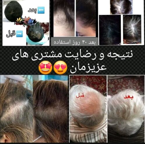 شامپو های ضد ریزش مو برای انواع کف سر