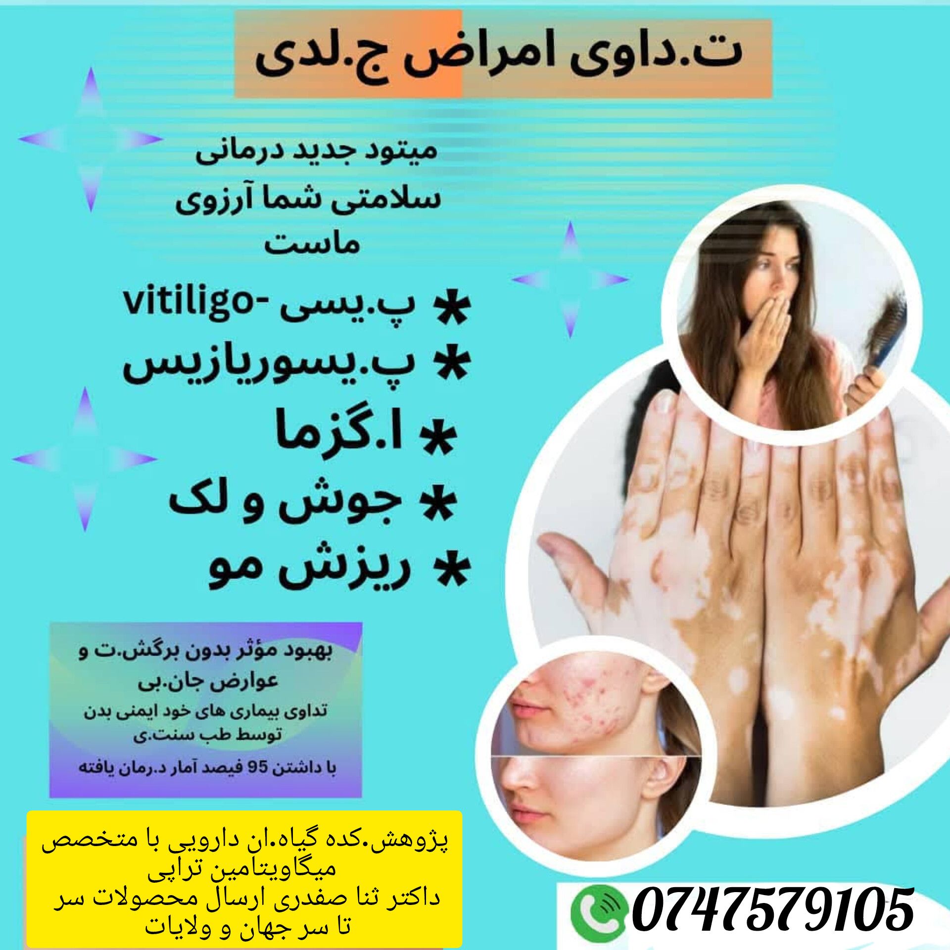 بیماری های خود ایمنی (پیسی و پسوریازیس