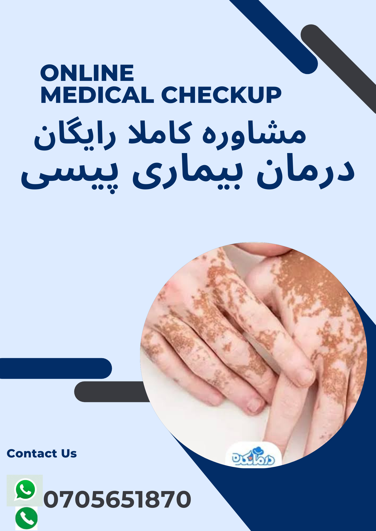 مشاوره رایگان بیماری پیسی