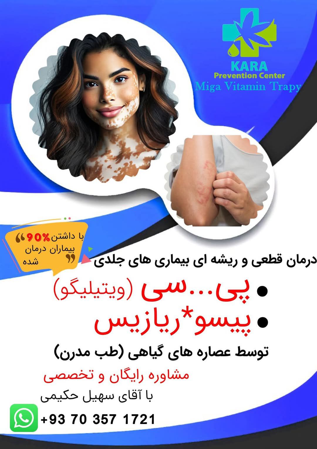 درمان قطعی و ریشه یی پیسی و پیسوریازیس