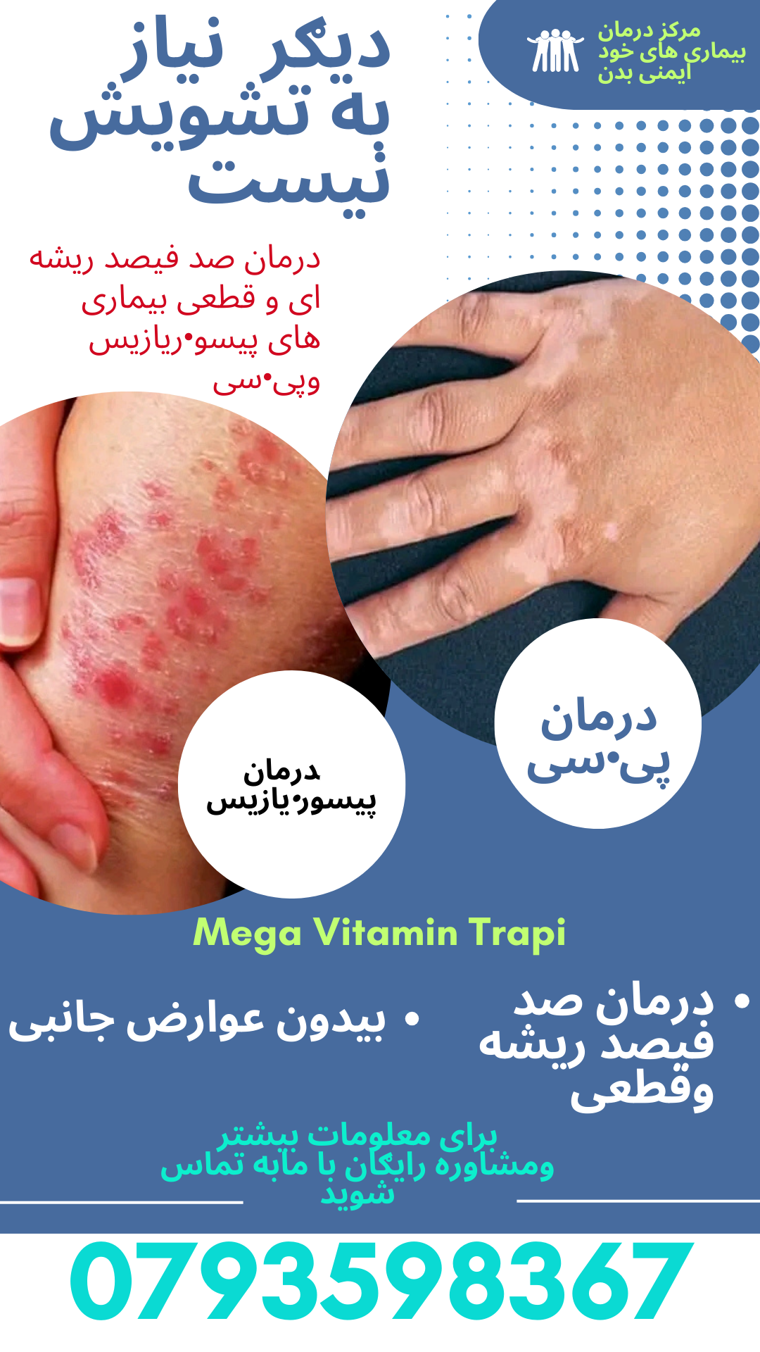 درمان بیماری های پیسی و پیسور یازیس