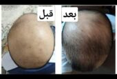 تونيک گیاهی تقویت کننده و ضد ریزش موی سر لدورا هرب
