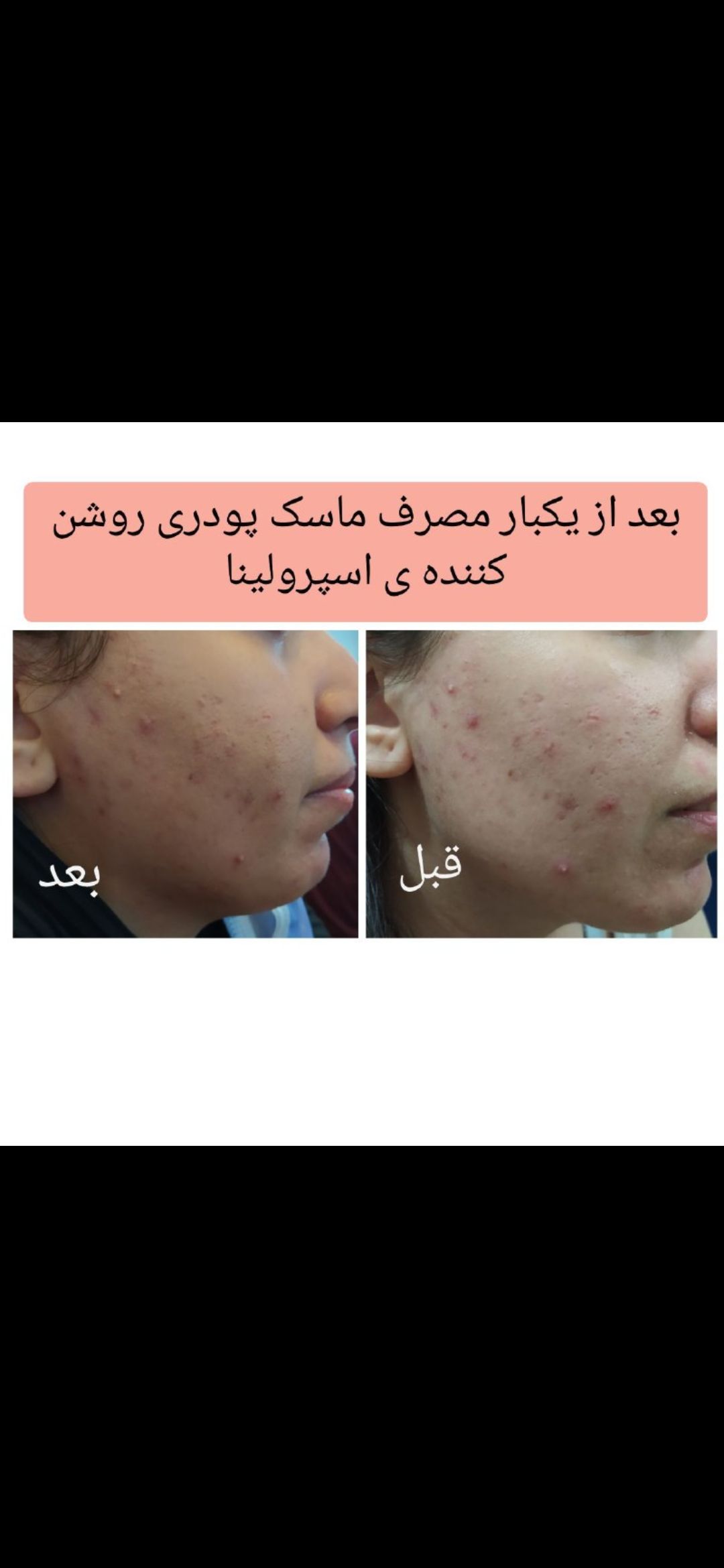 ماسک پودری اسپیرولینا ضدجوش لدورا