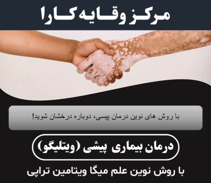 درمان قطعی وریشه یی بیماری پیسی(وتلیگو)