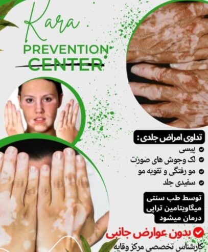 درمان مشکلات جلدی و راهکار زیبایی عید کم مانده اه