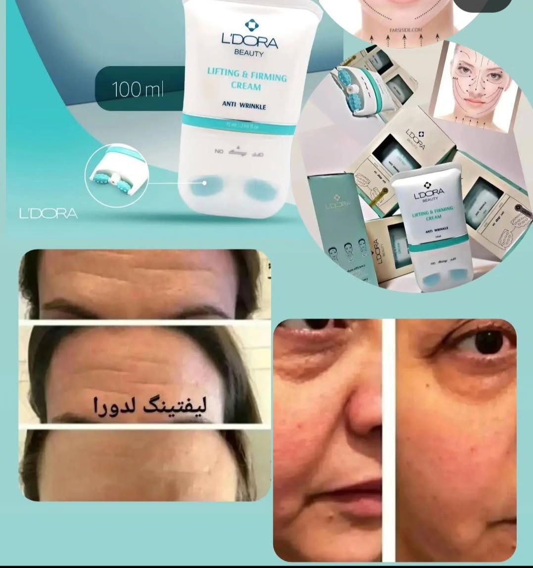 کریم سفید کننده لدورا هیربیل با ضمانت