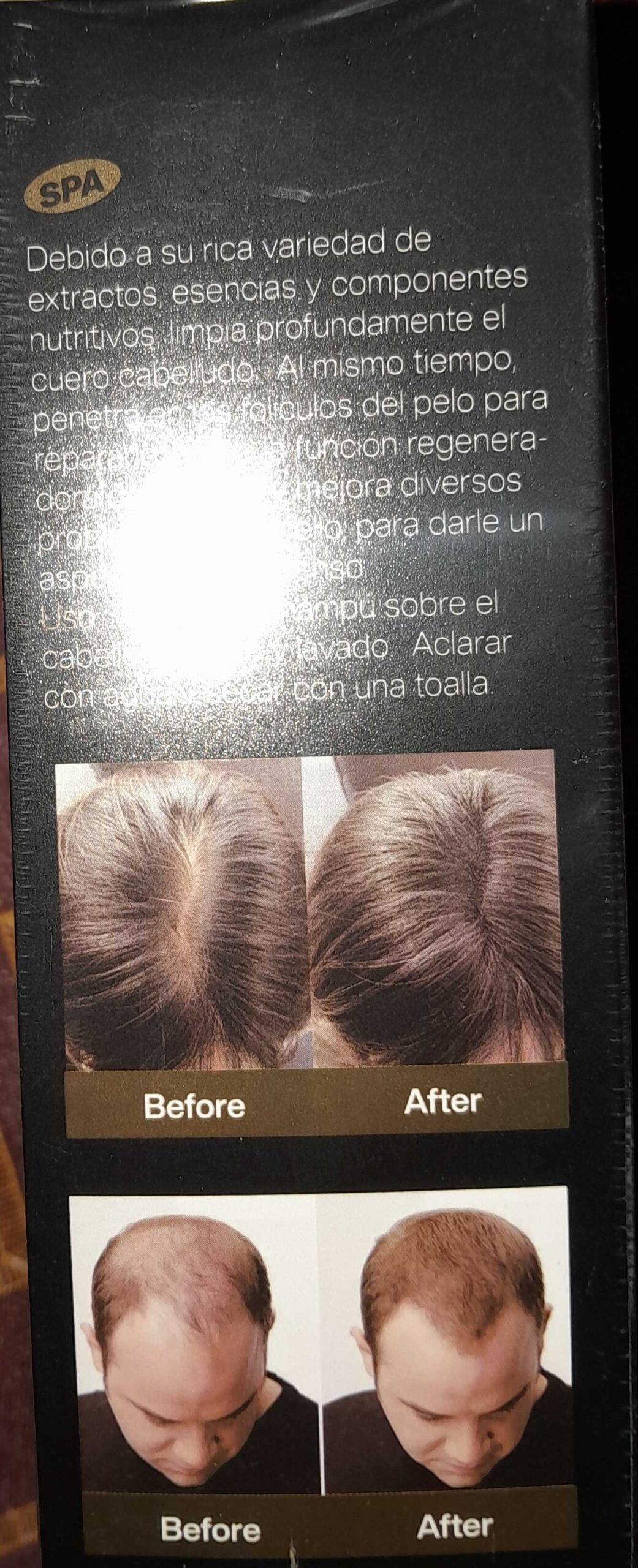 شامپوی اورجينال تولید کشور انگلستان برای سبوسک و م