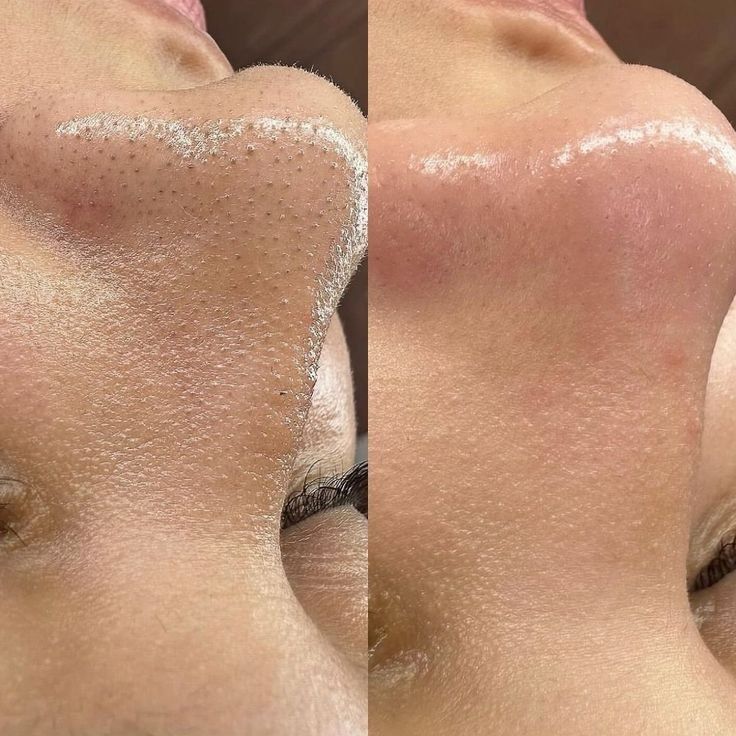 ماسک اسکراب Sea Oyster