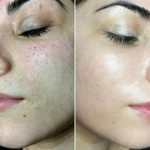 ماسک روشن کننده لکه های تاریک صورت