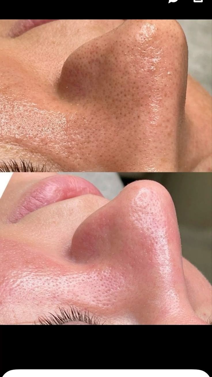 اسکراب قهوه