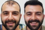 تونیک تقویت کننده و ضدریزش مو