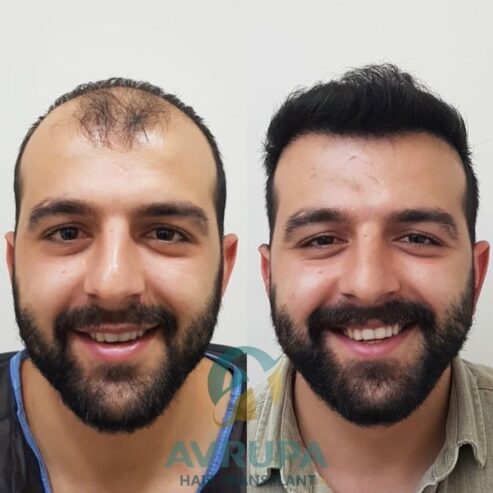 تونیک تقویت کننده و ضدریزش مو