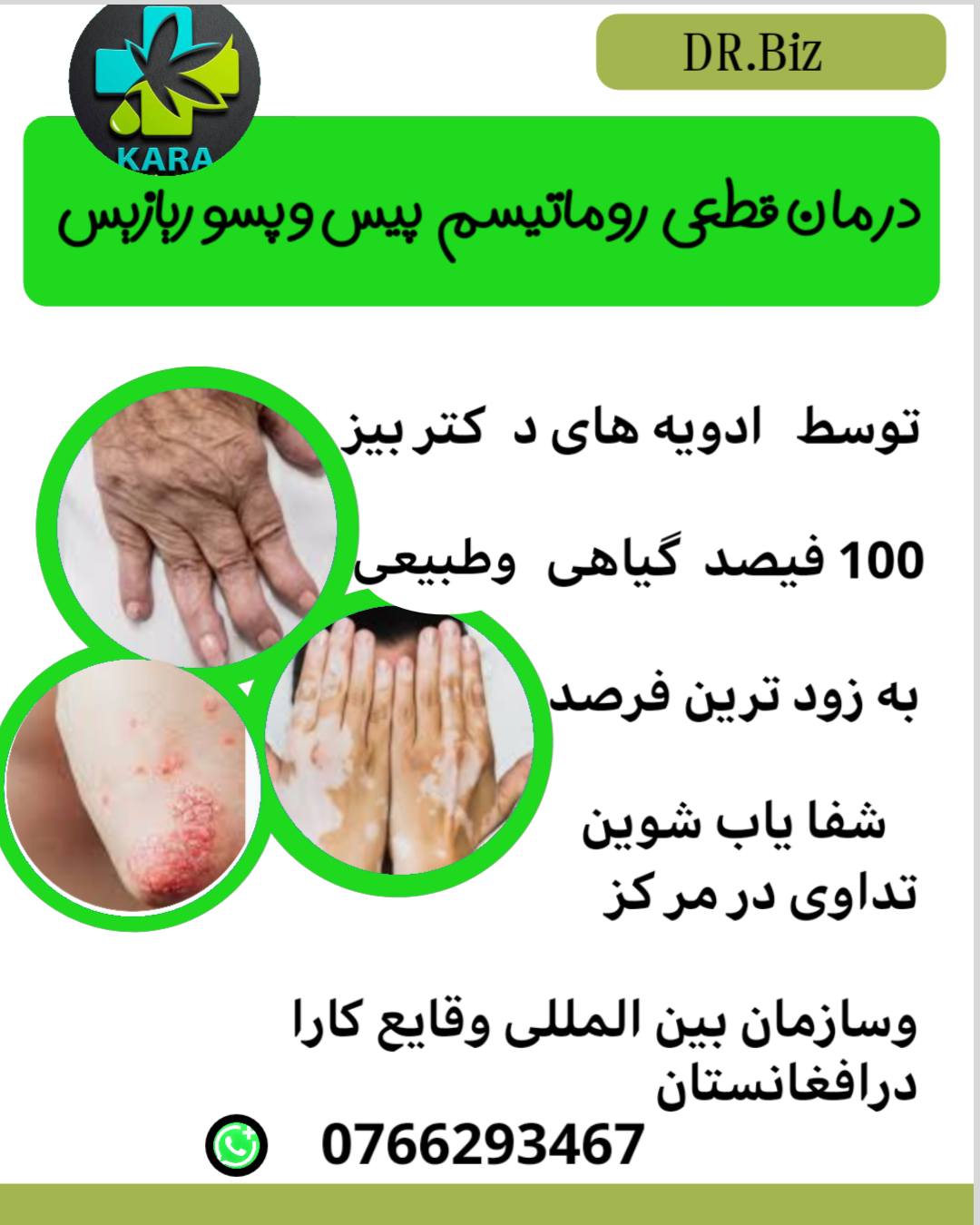 شامپو کریم زد چین وچروک وتداوی روماتیسم پیس وپسو ر