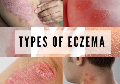 8093a2b5-ef0c-40ae-a430-cdbdb220ae25