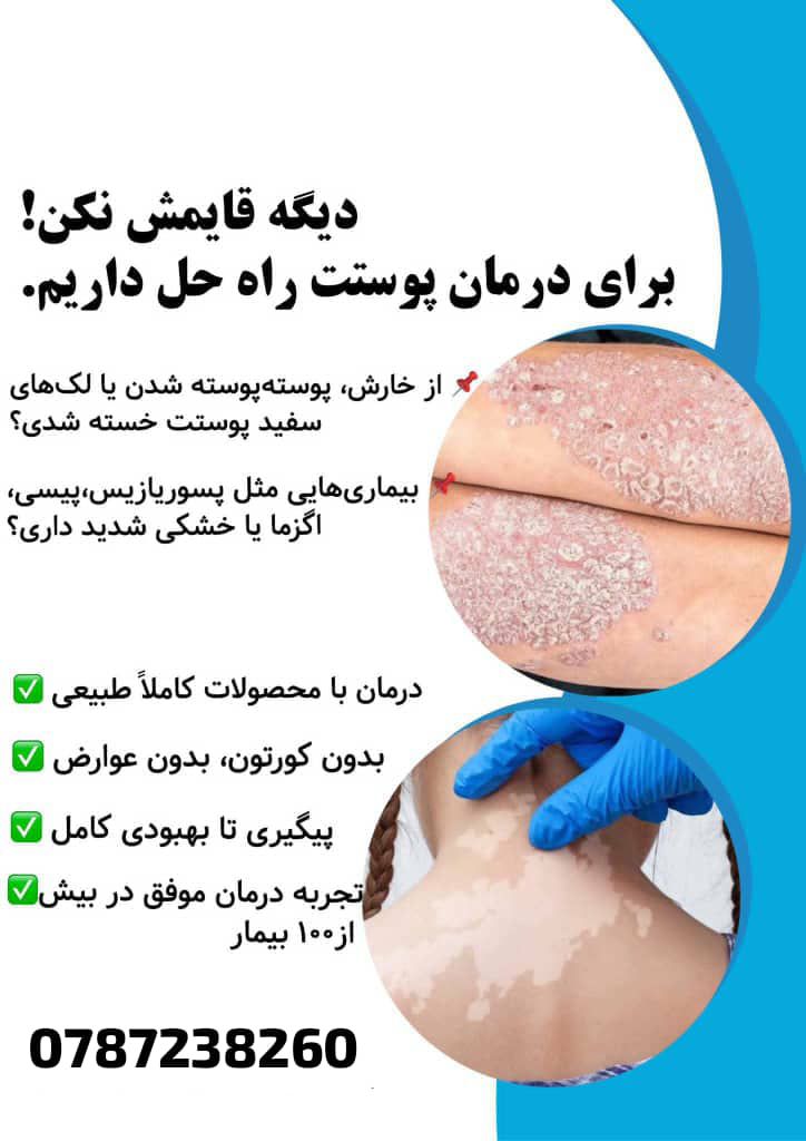 درمان ریشه یی وقطعی بیماری های پیسی پیسوریازیس و ا