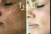 ماسک گیاهی شاداب کننده و از بین برنده چین و چروک