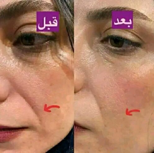 ماسک گیاهی شاداب کننده و ضد چین و چروک